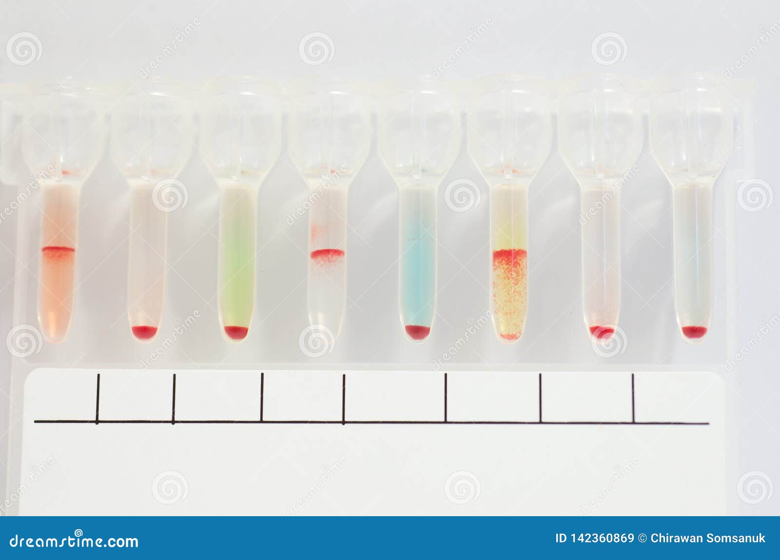 Blood Group ABO Typing Gel Test Stock Image Image of method, research