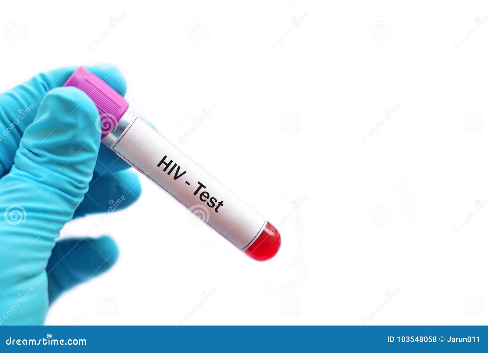 Blood for HIV test stock photo. Image of technology 103548058