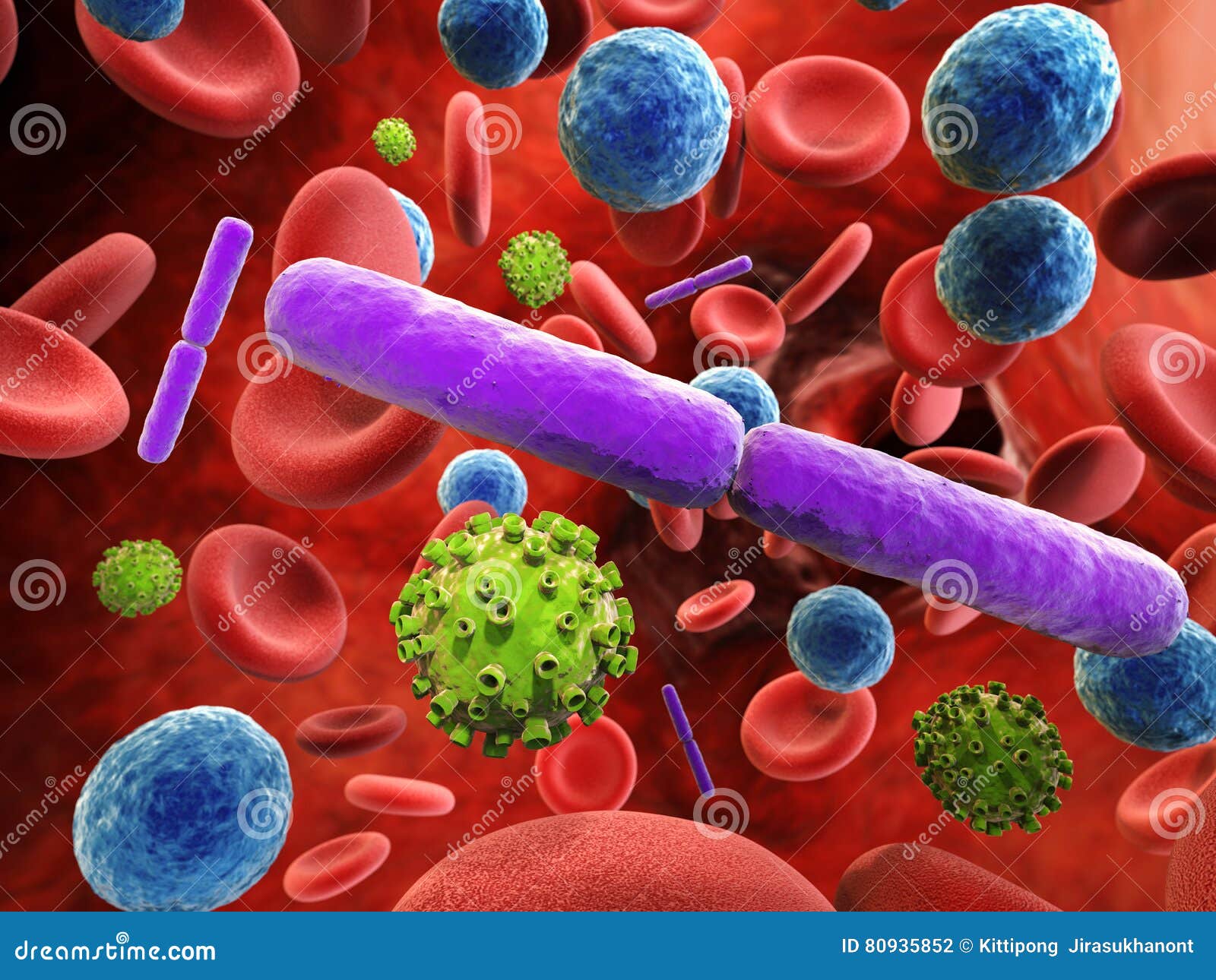 blood infection with bacteria and virus cells