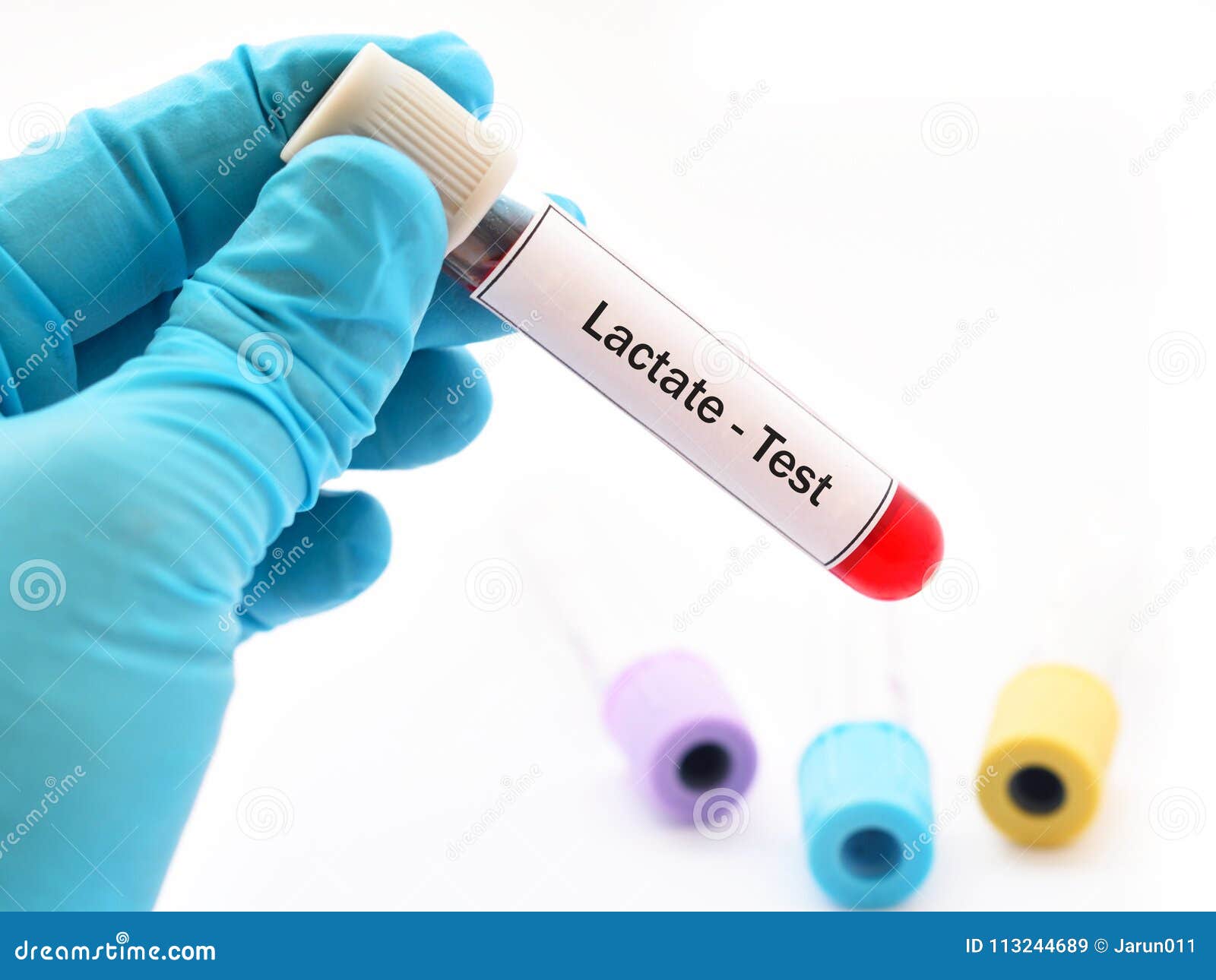 Blood for lactate test stock image. Image of sample 113244689