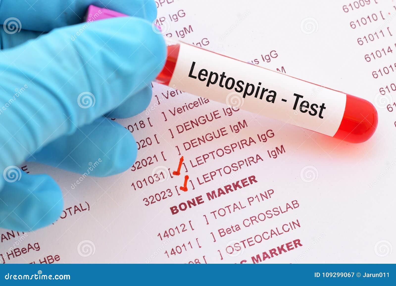 Blood for leptospira test stock image. Image of medical 109299067 Blood for leptospira test stock image. Image of medical 109299067