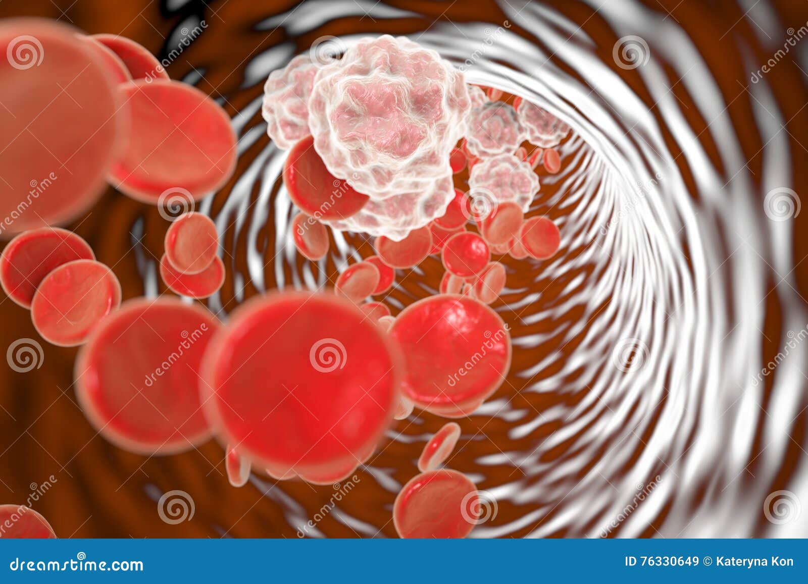 blood in patient with inflammation