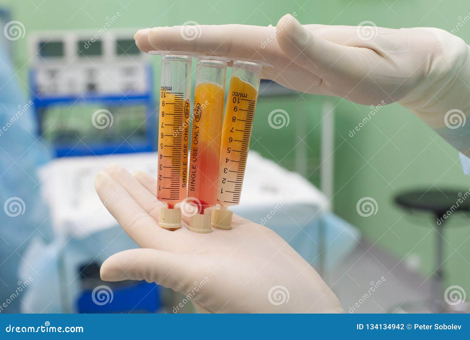 Blood Plasma in Cosmetic Medicine Stock Photo Image of chemical