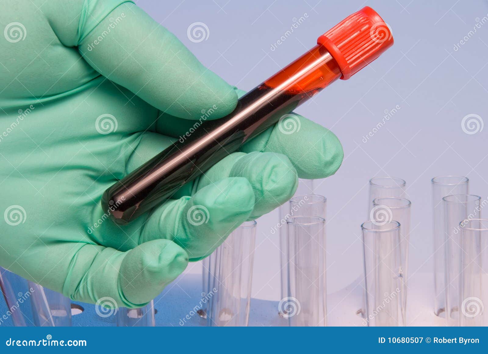 Blood Sample Tube For Ddimer Test Stock Photography CartoonDealer