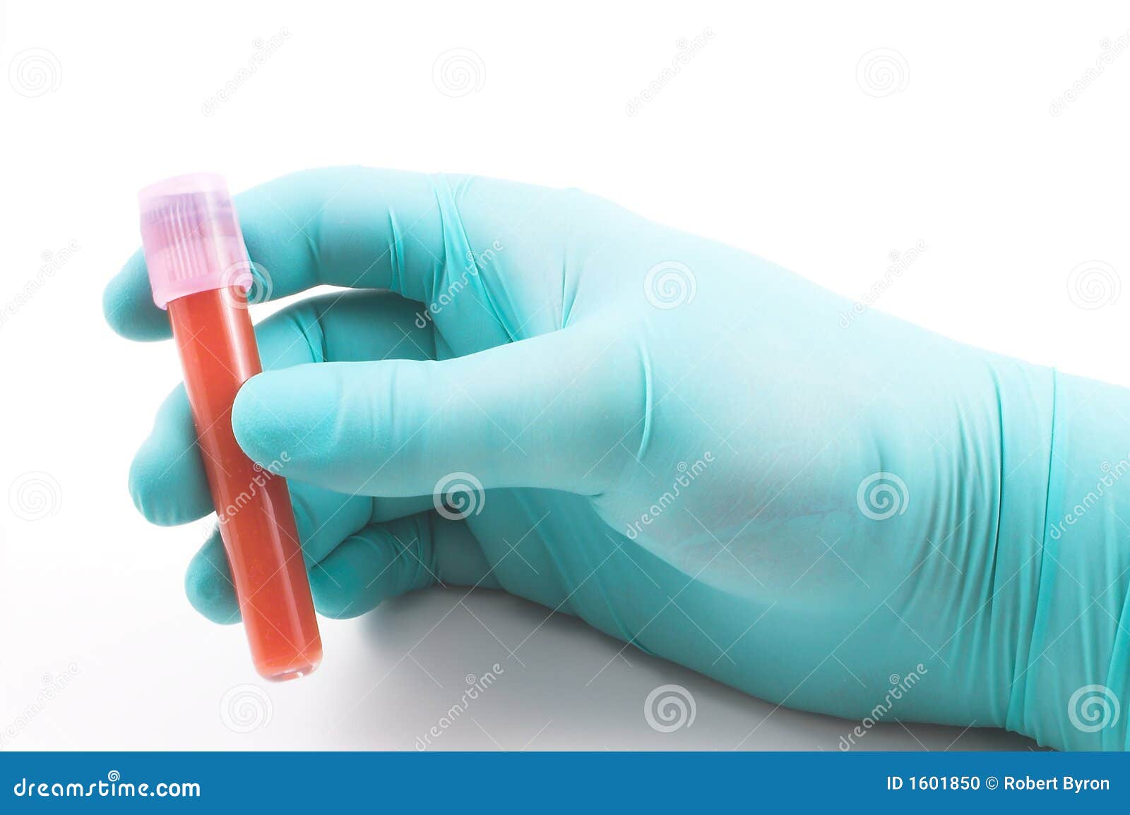 Blood Sample Tube For Ddimer Test Stock Photography CartoonDealer