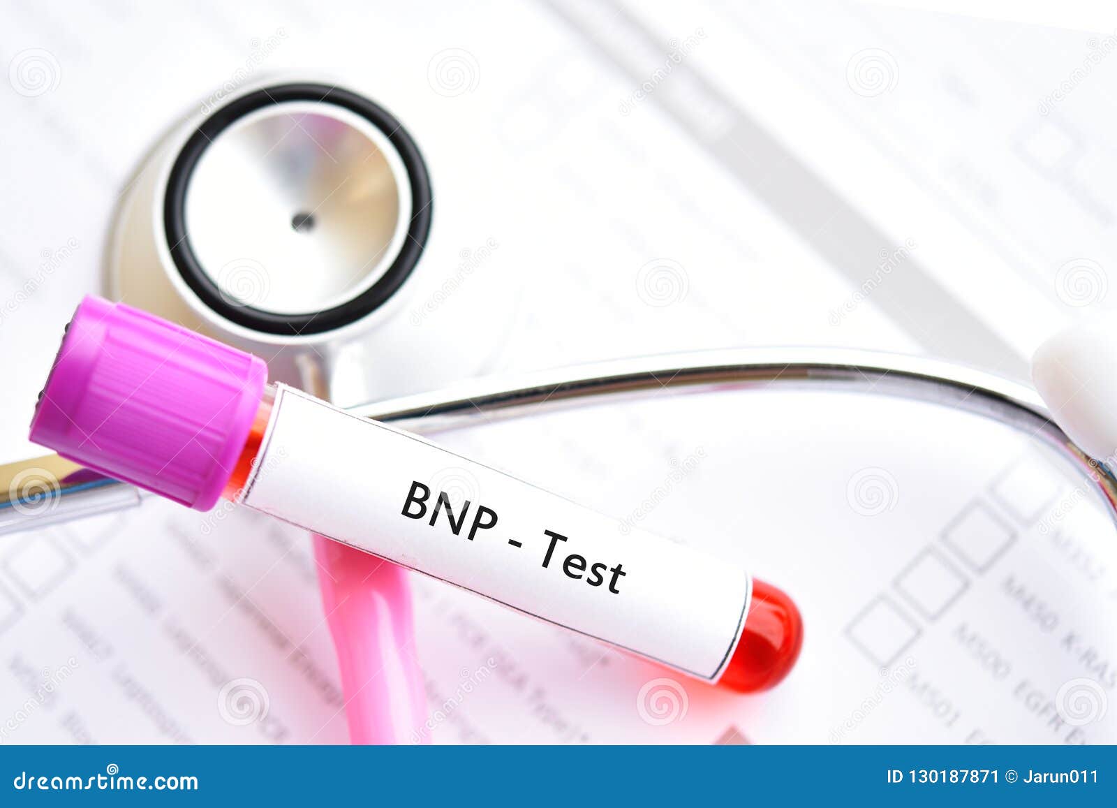 Blood Sample For Bnp Test Stock Image Image Of Checkup 130187871