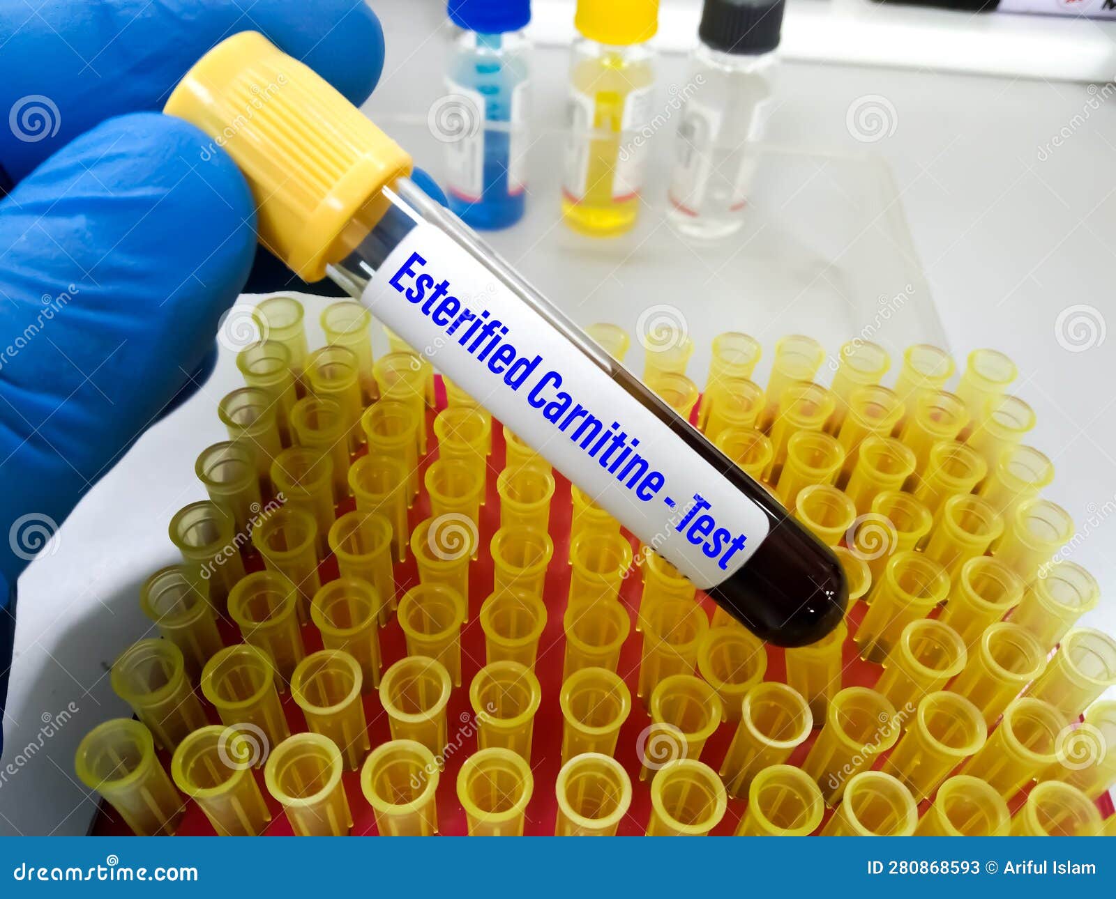 Blood Sample for Esterified Carnitine Test Stock Image Image of hematology, essential 280868593