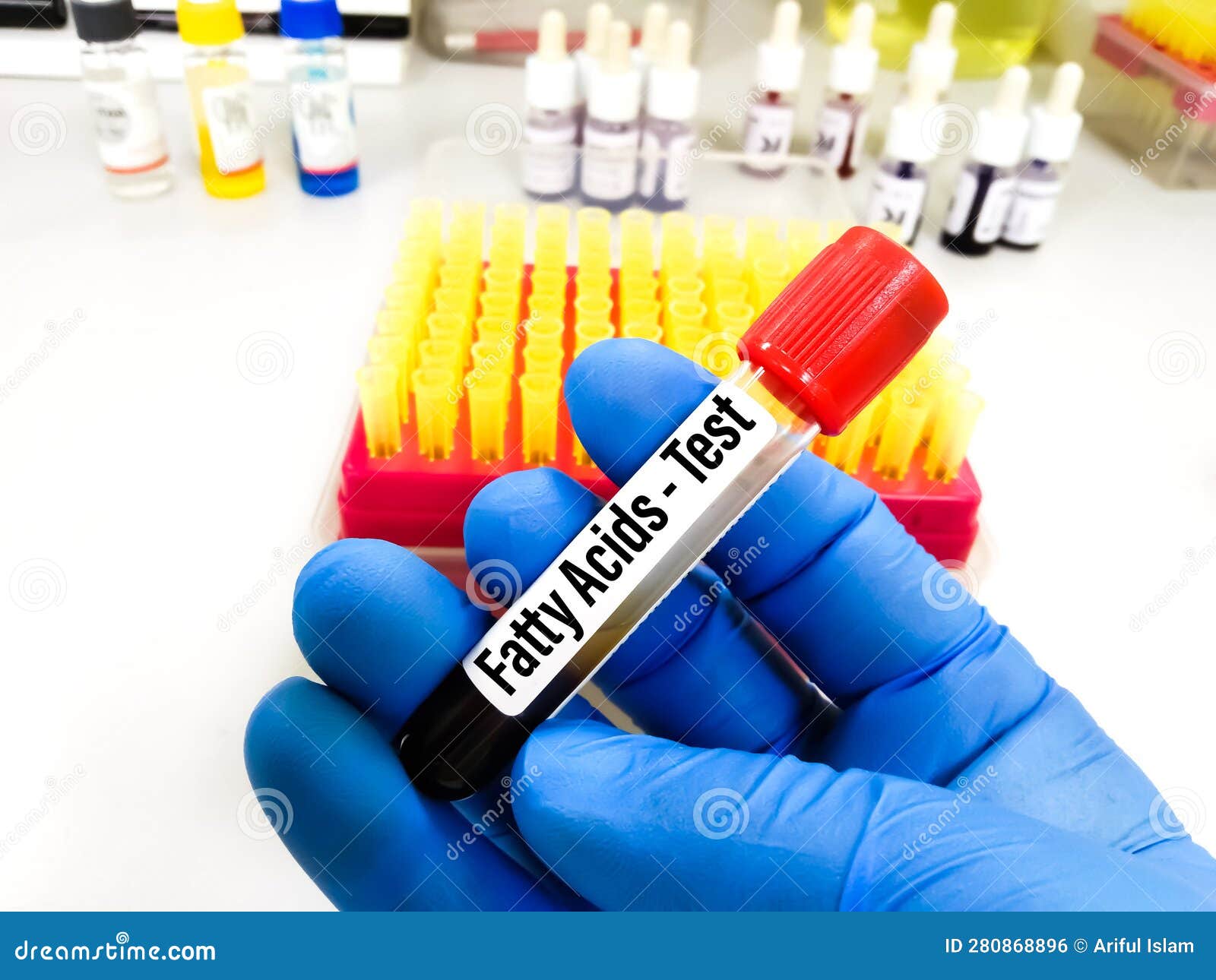 Blood Sample for Fatty Acid (Essential and Nonessential) Test. Stock