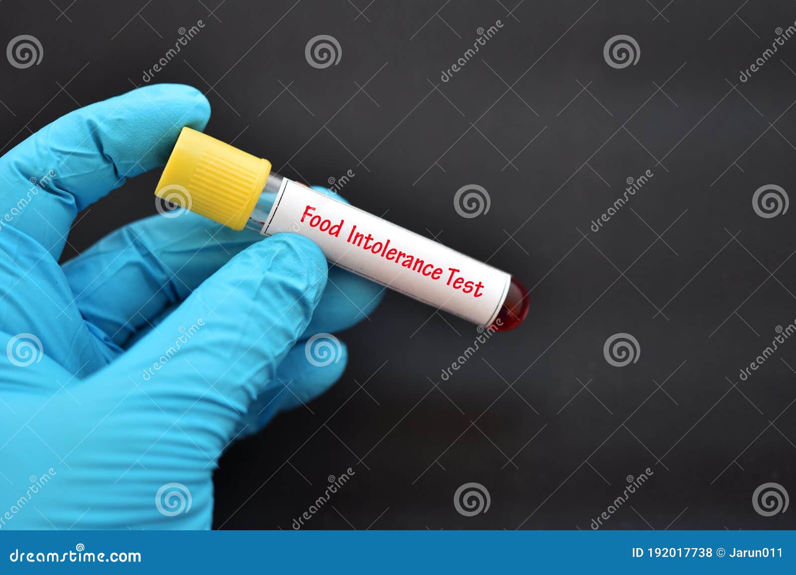 Blood Sample For Food Intolerance Test Stock Photo Image Of blood-sample-for-food-intolerance-test-stock-photo-image-of