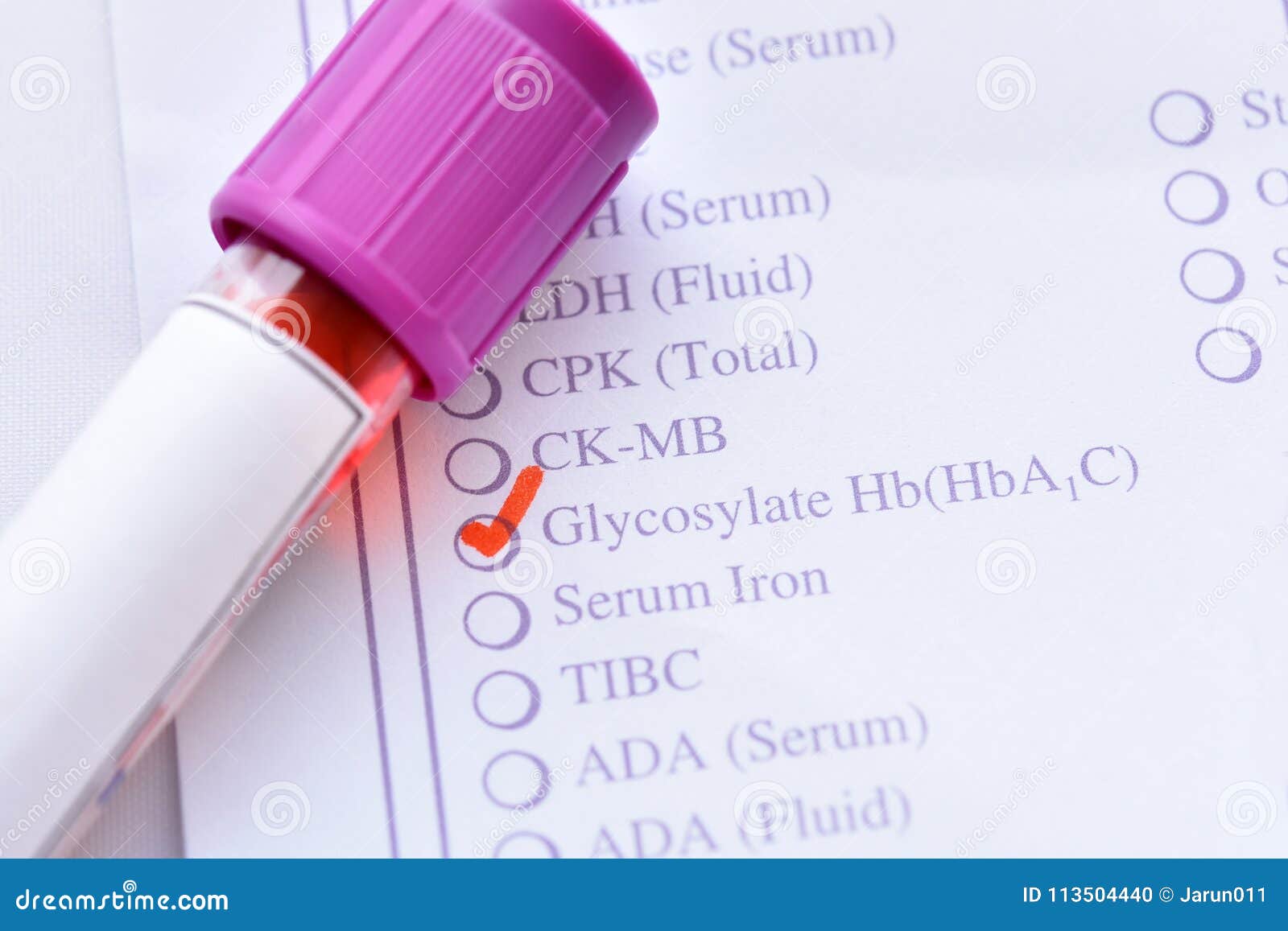 Blood Sample for HbA1c Test Stock Photo Image of blood, chemistry