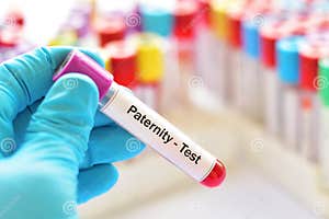 Blood Sample For Paternity Test Stock Image Image Of Genetic Medical 125753363