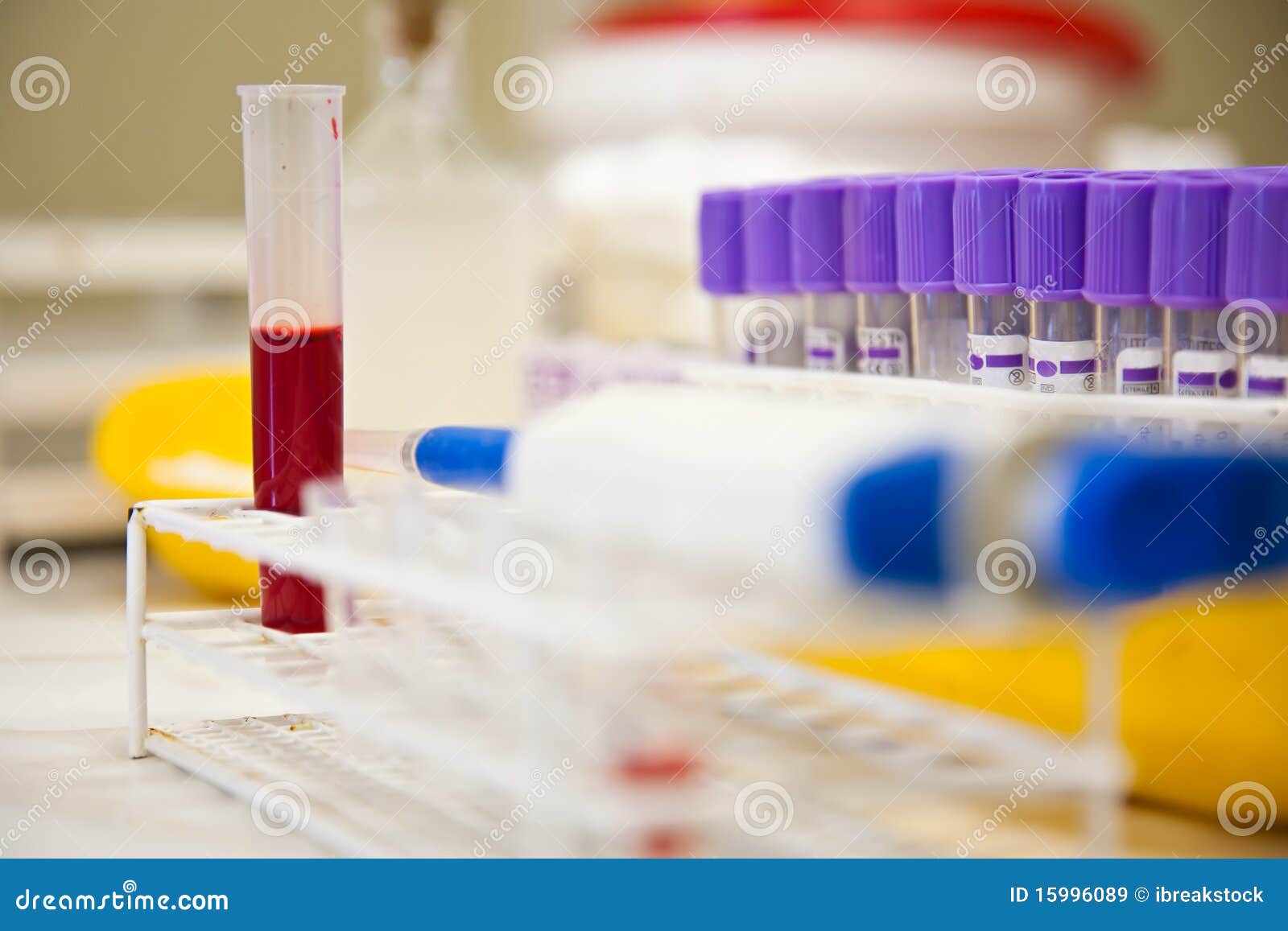 Blood Sample and a Pipette in the Lab Stock Image Image of