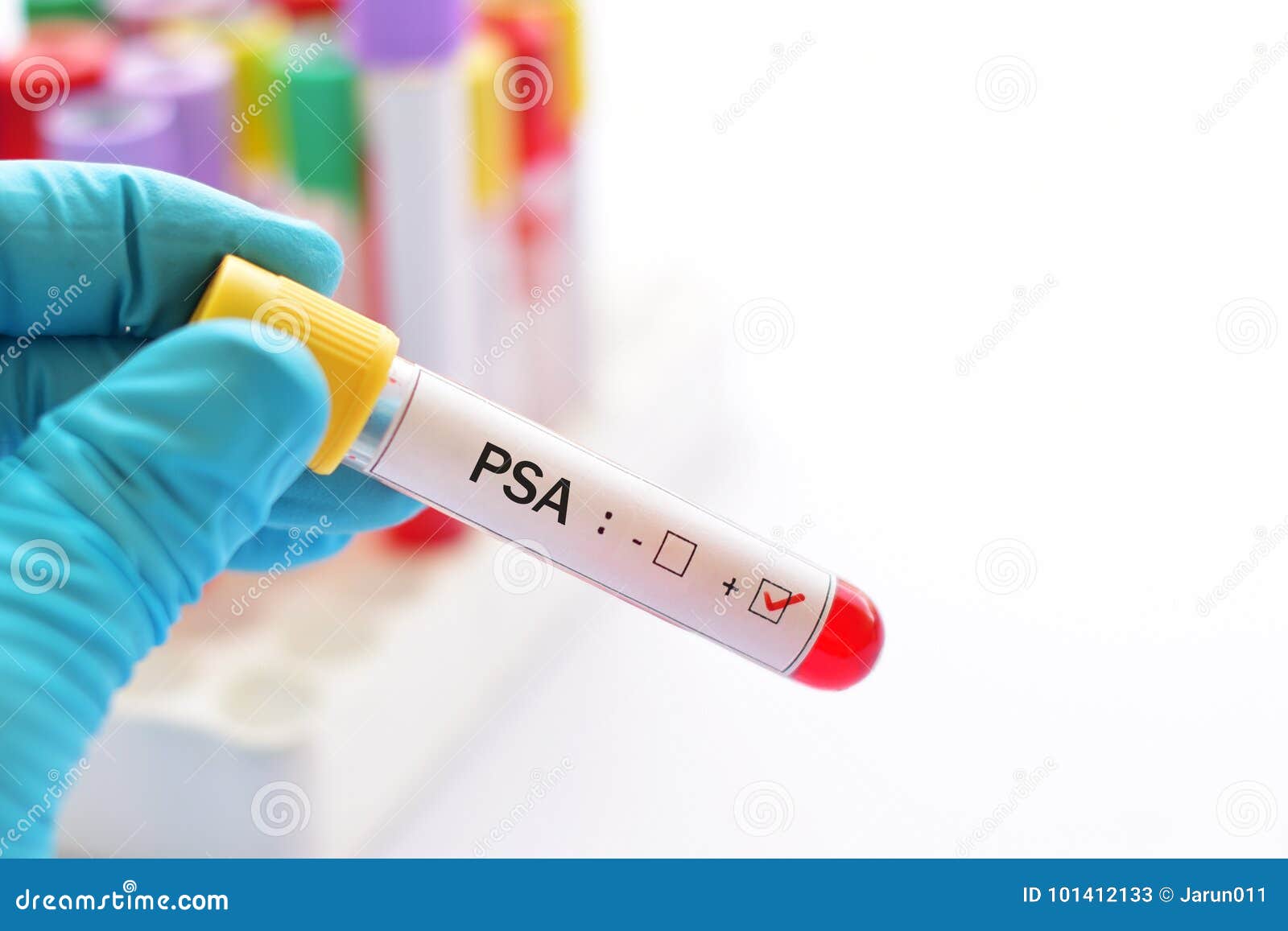 PSA positive stock image. Image of science, care, positive - 101412133
