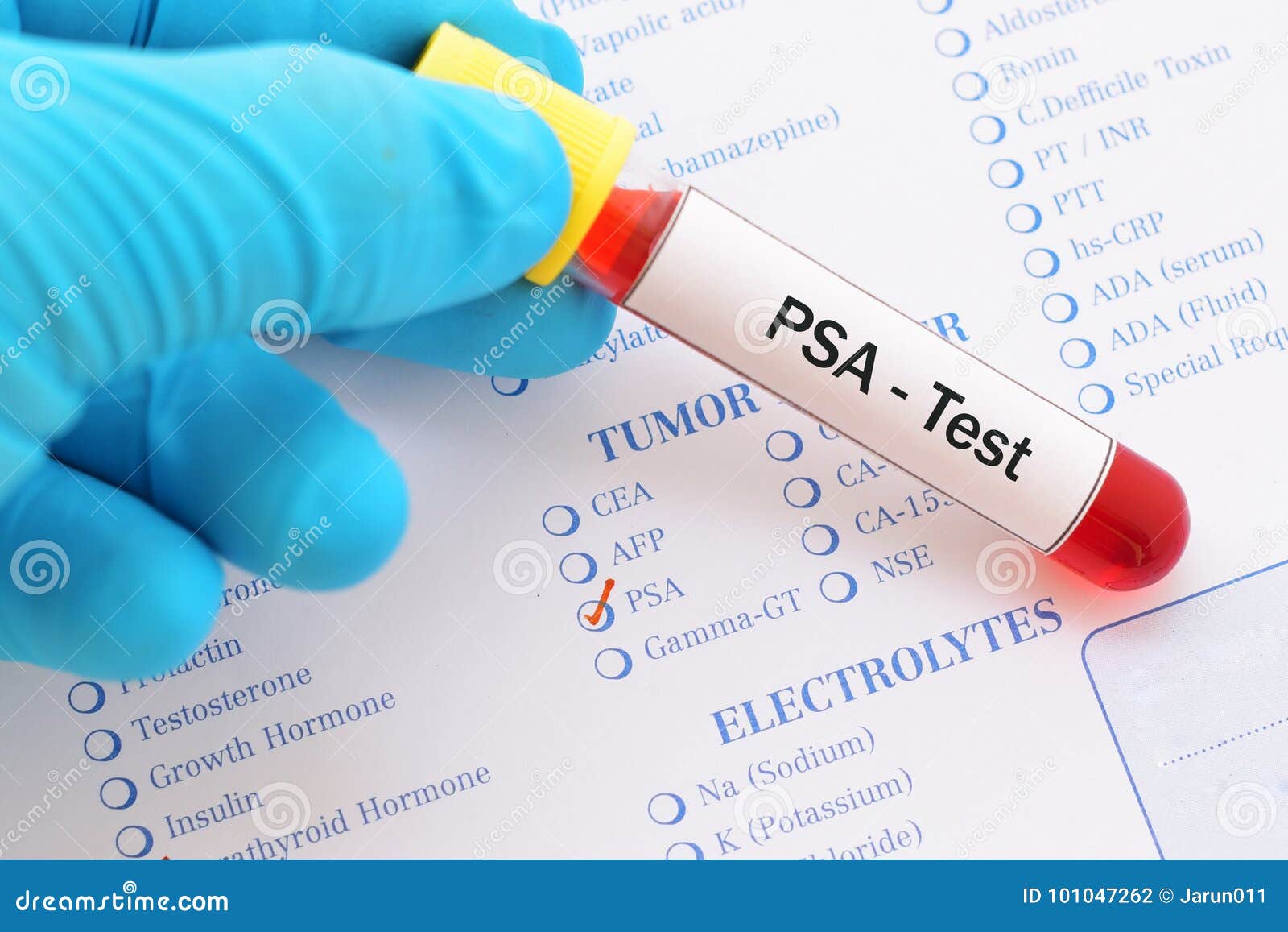 PSA test stock photo. Image of analyzing, serology, laboratory - 101047262