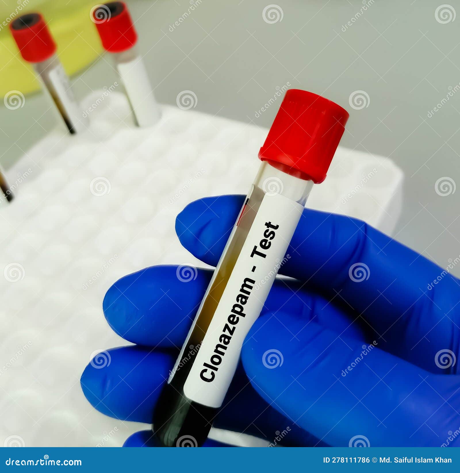 Blood Sample for Serum Clonazepam Label Test Stock Photo Image of Blood Sample for Serum Clonazepam Label Test Stock Photo Image of