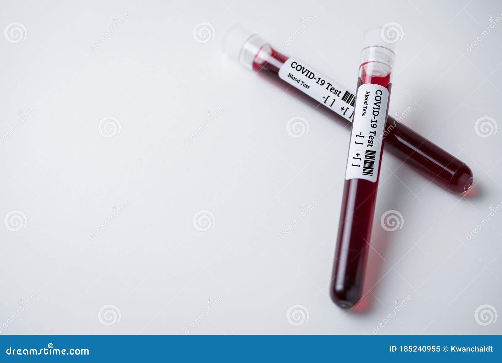 Mẫu máu là yếu tố quan trọng trong chẩn đoán và điều trị bệnh. Hãy xem bức ảnh liên quan đến mẫu máu để hiểu thêm về tầm quan trọng của kiểm tra máu đối với sức khỏe của bạn.