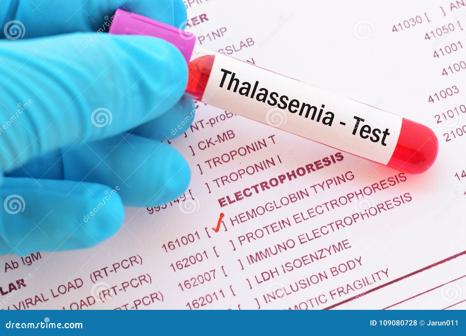 Blood Sample for Thalassemia Test Stock Photo Image of medicine