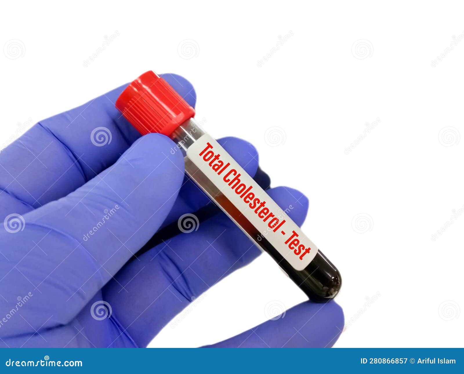 Blood Sample for Total Cholesterol Test Stock Image Image of