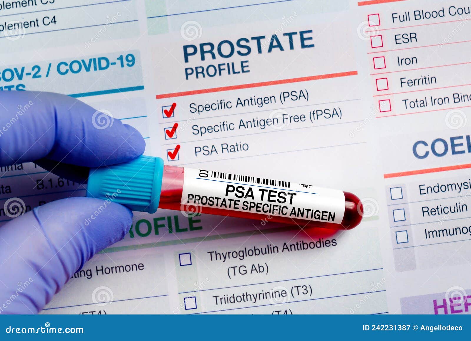 Blood Tube Test with Requisition Form for PSA Prostate Specific Antigen