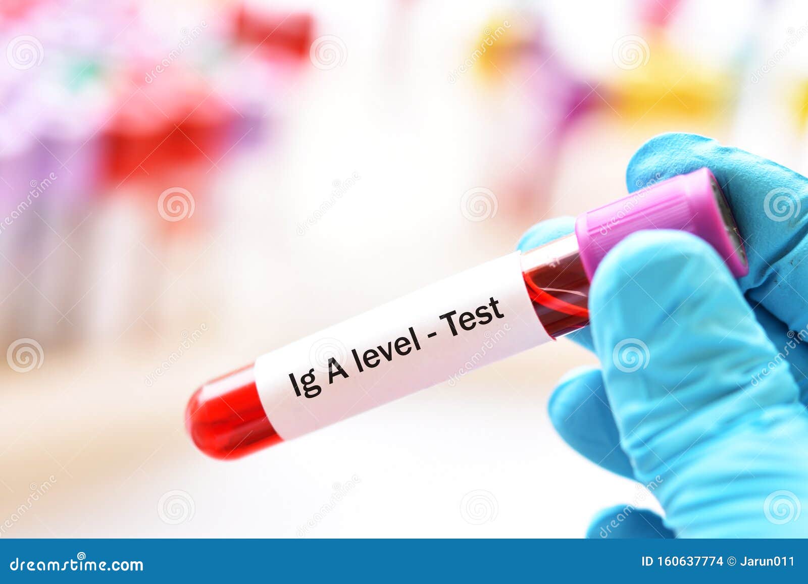 Blood Sample Tube for Immunoglobulin a or IgA Level Test Stock Photo Blood Sample Tube for Immunoglobulin a or IgA Level Test Stock Photo