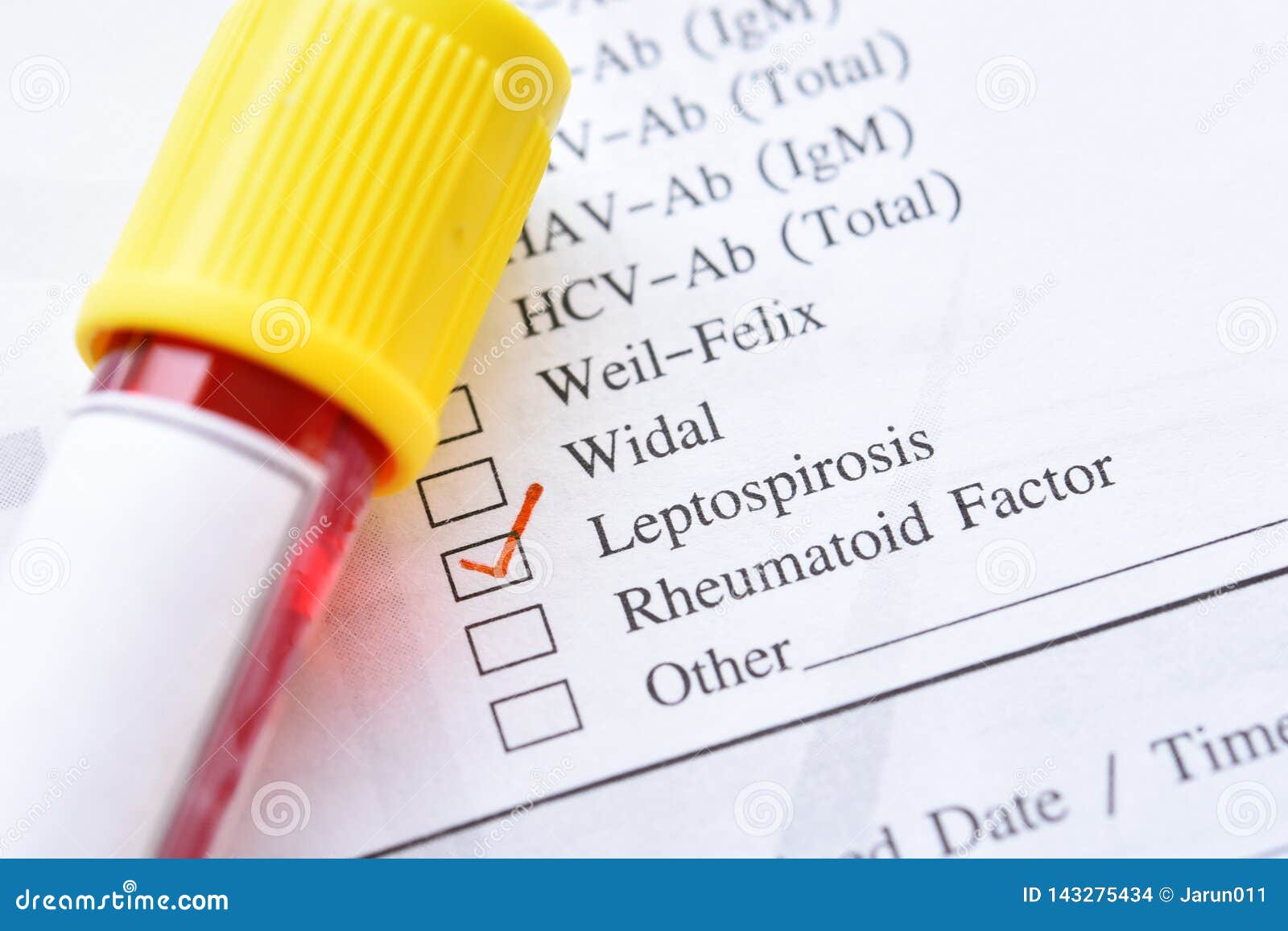 Leptospirosis Test With Blood Sample. Top View Isolated On Black Leptospirosis Test With Blood Sample. Top View Isolated On Black