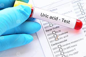 Blood For Uric Acid Test Stock Photography CartoonDealer 106681808