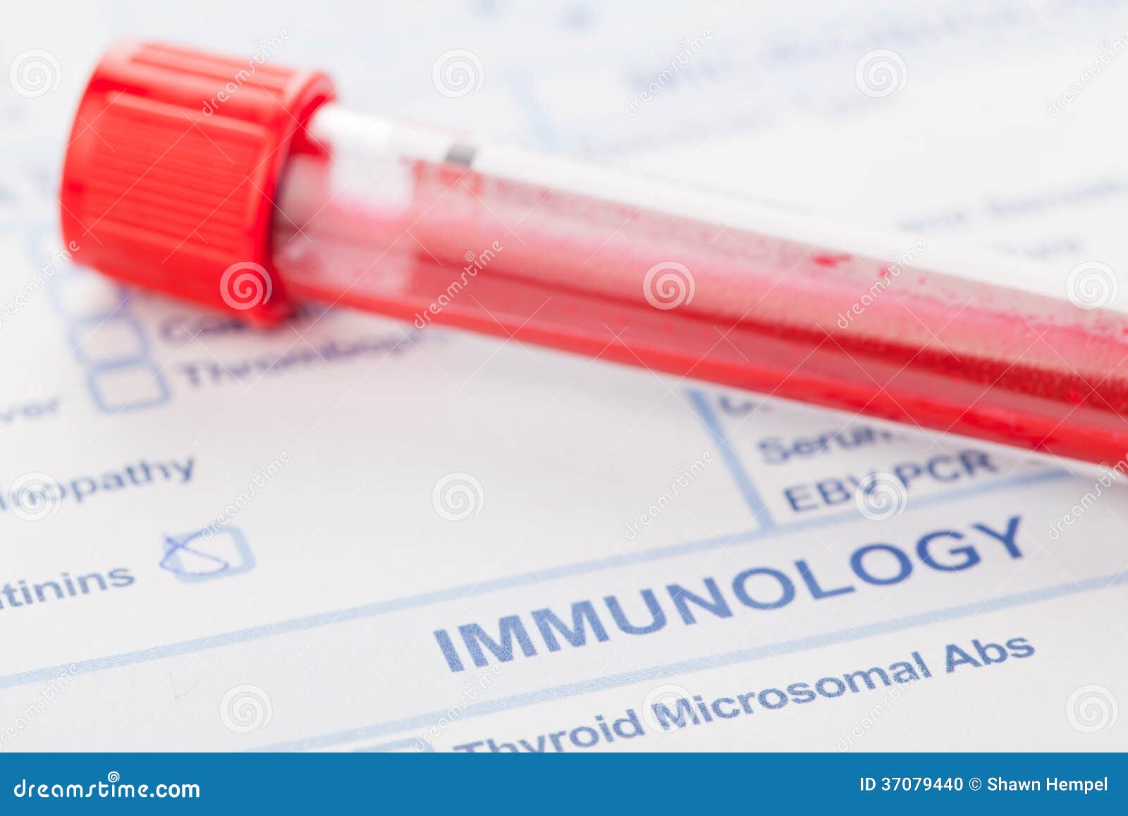 Blood sample stock photo. Image of document, industry 37079440