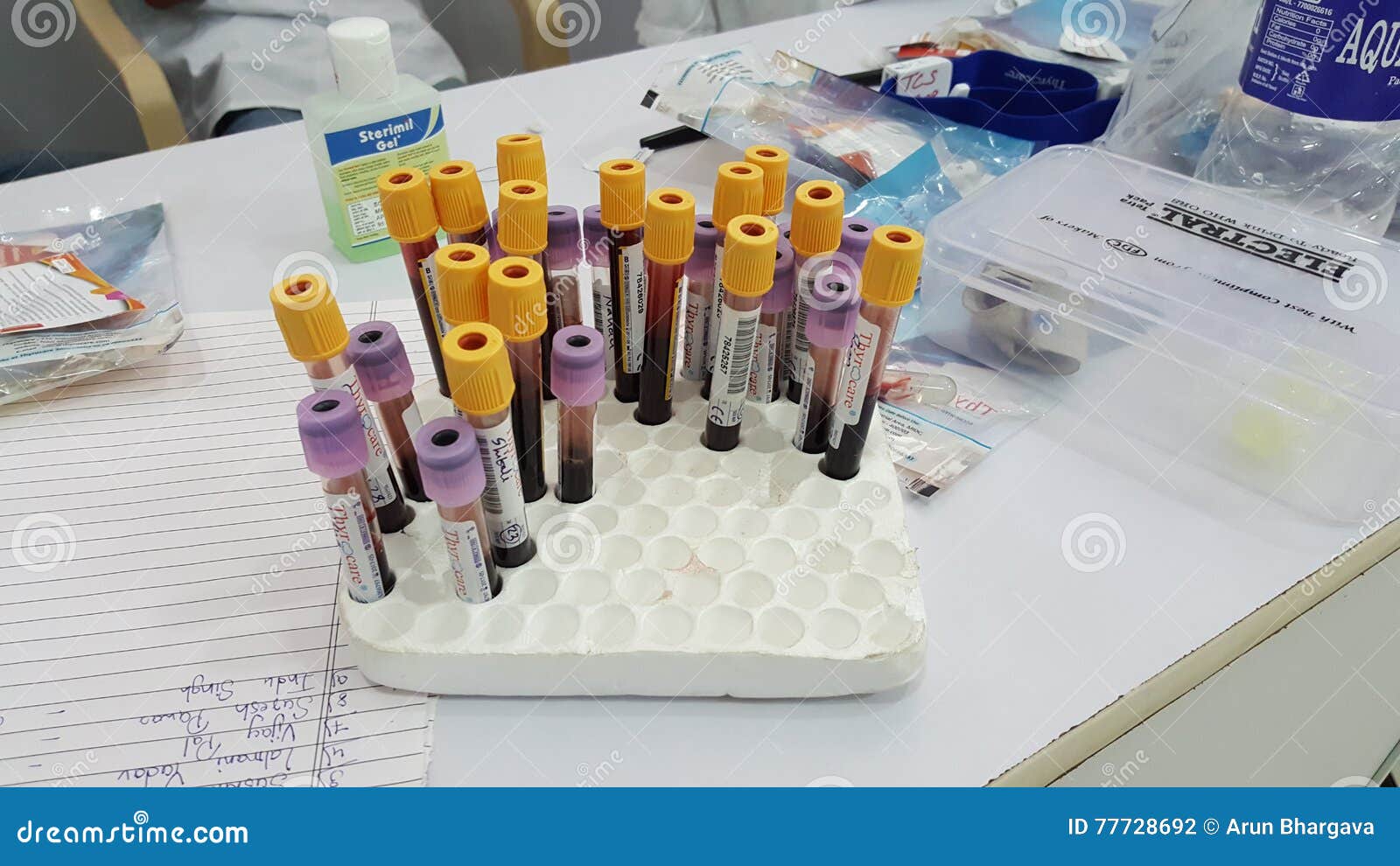 Blood Samples editorial photography. Image of pathology 77728692