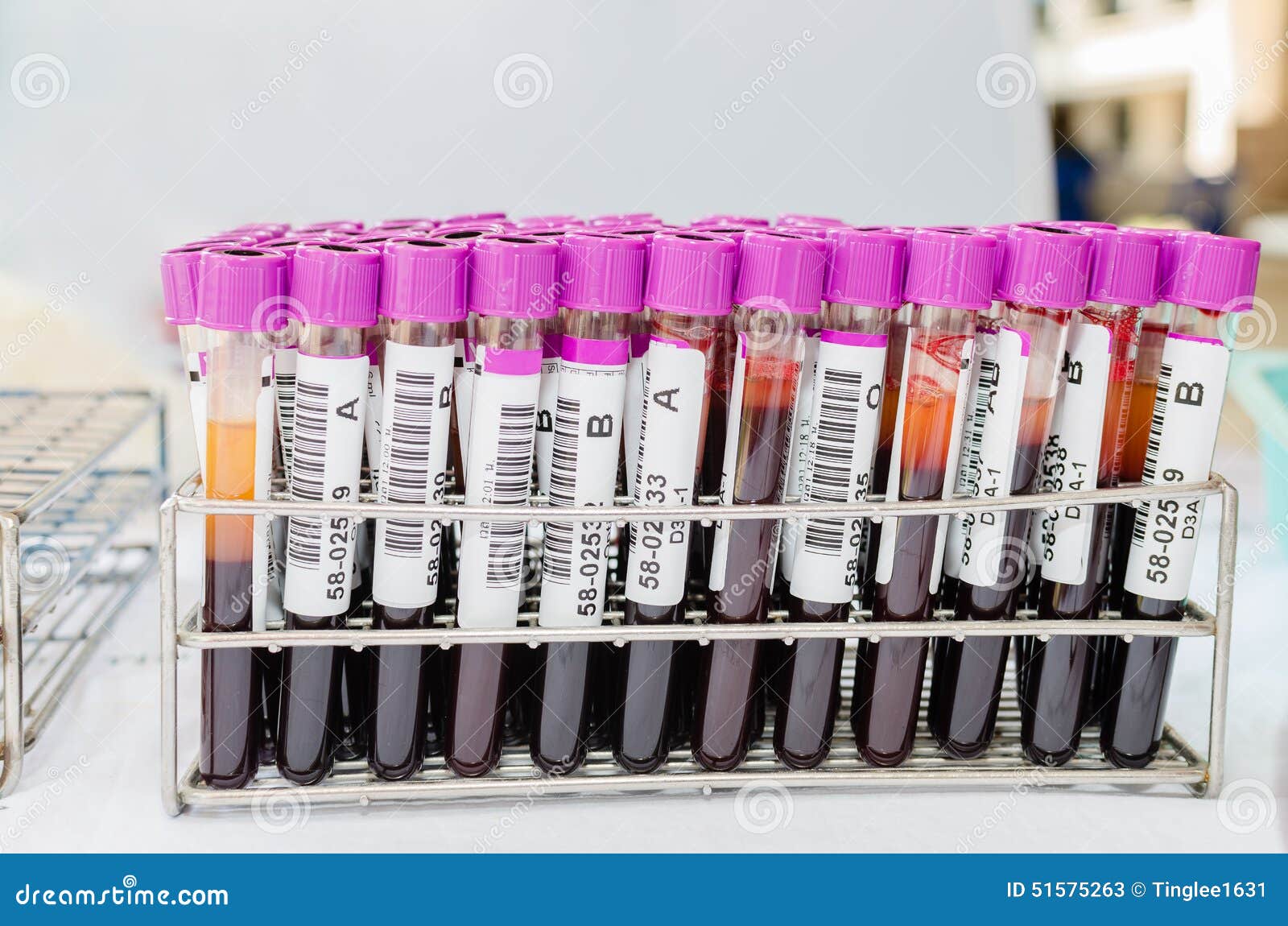 Blood samples stock image. Image of beaker, microbiology 51575263