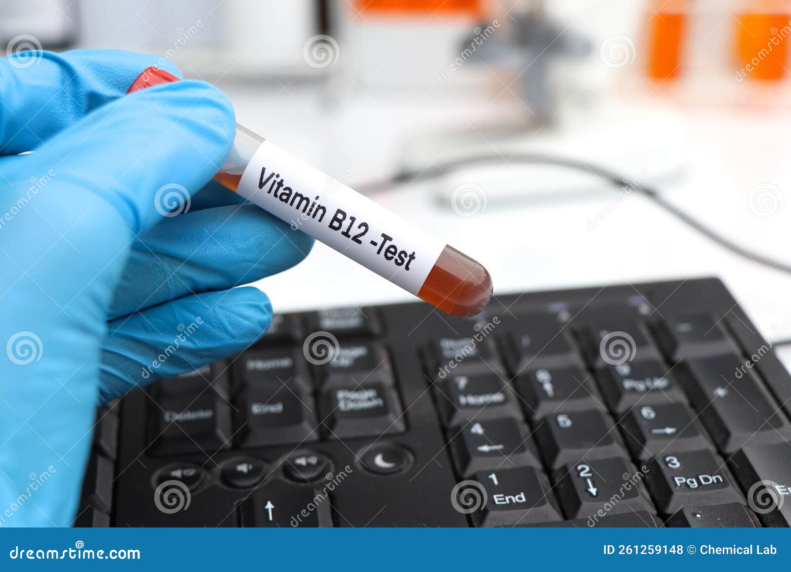 Blood Samples for Testing Vitamin B12 in the Laboratory Stock Photo Blood Samples for Testing Vitamin B12 in the Laboratory Stock Photo