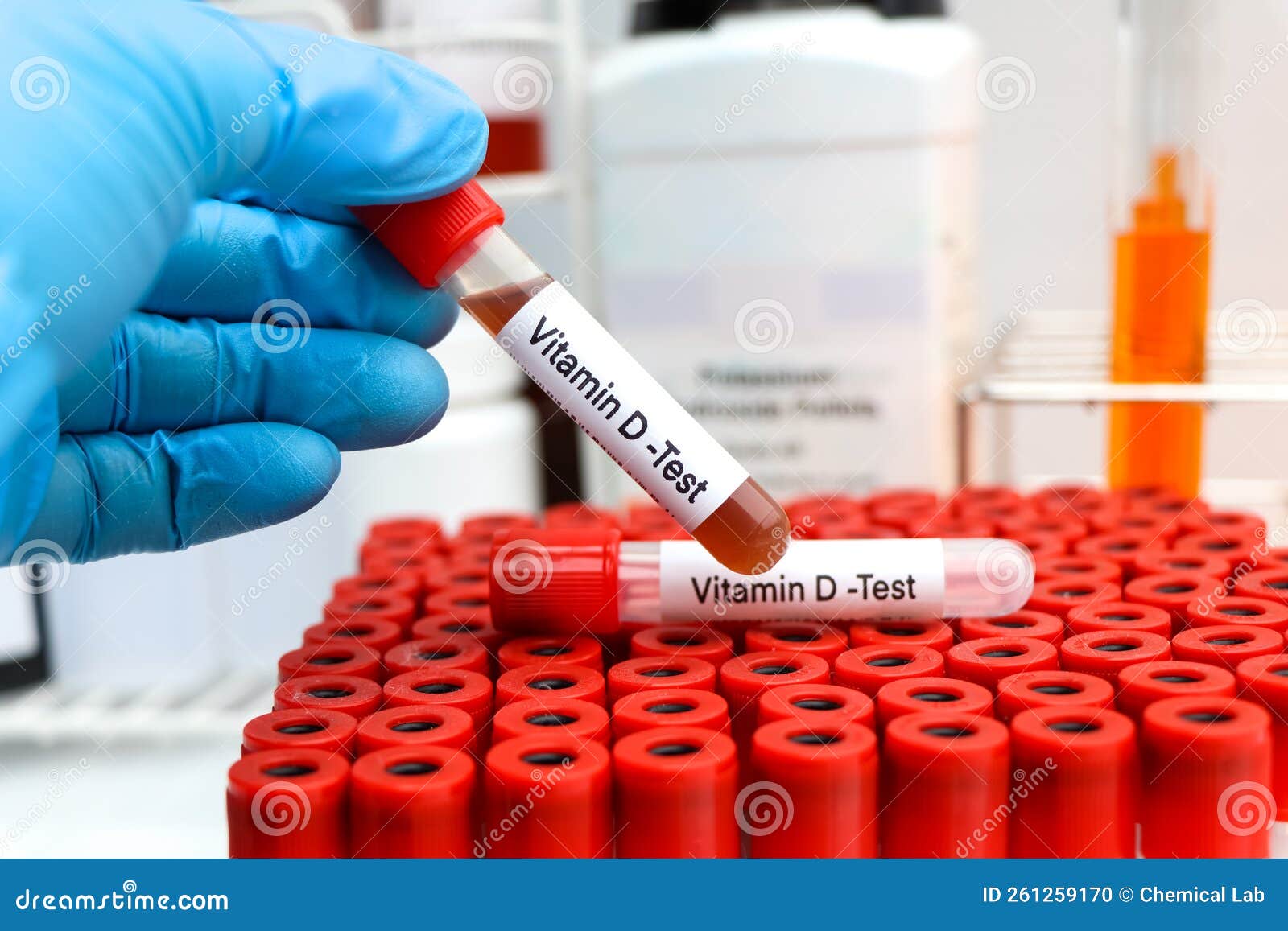 Blood Samples for Testing Vitamin D in the Laboratory Stock Photo Blood Samples for Testing Vitamin D in the Laboratory Stock Photo
