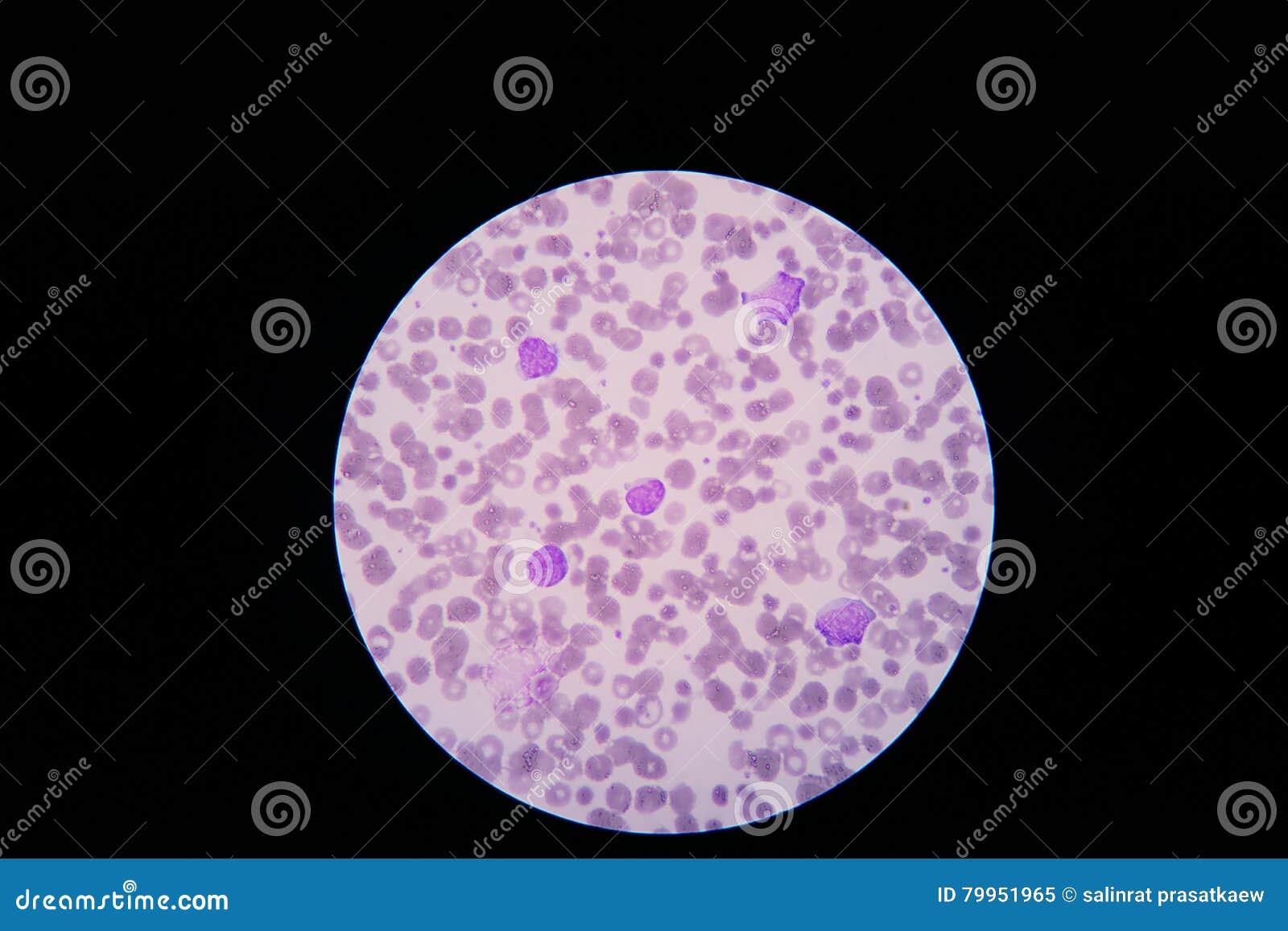 Blood Smear Showing Under Microscope Stock Image Image of blood