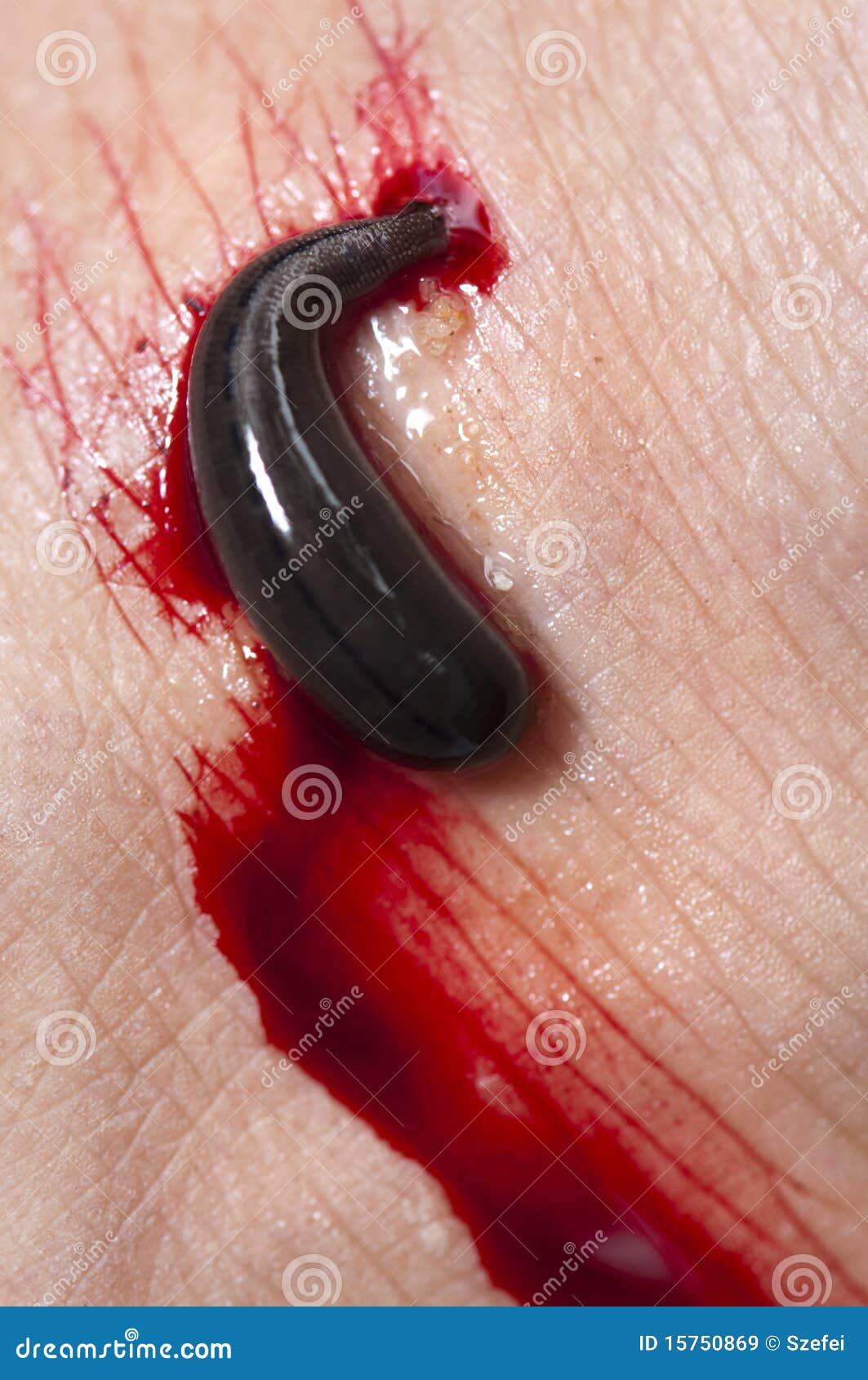 leech blood leech blood