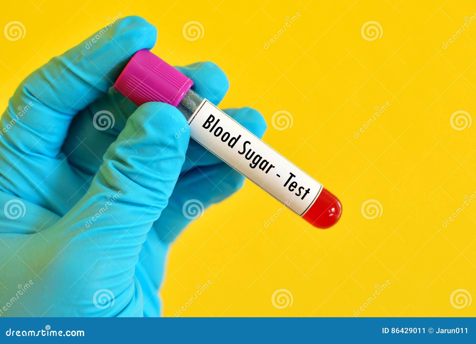 Blood sugar test stock image. Image of carbohydrate, hba1c 86429011