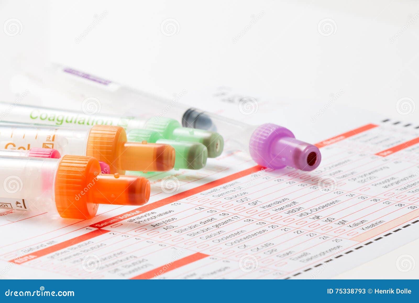 Blood Test, Blood Samples on a Laboratory Form Stock Image - Image of ...