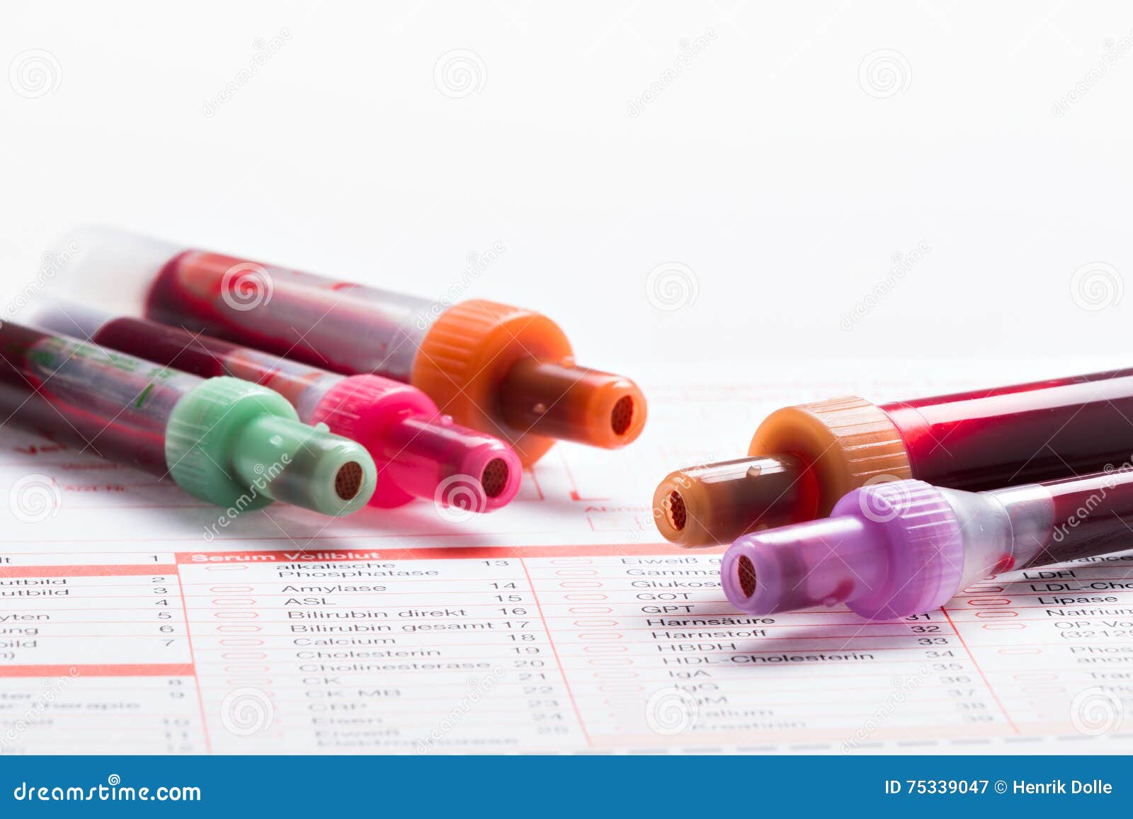 Blood Test, Blood Samples on a Laboratory Form Stock Image Image of