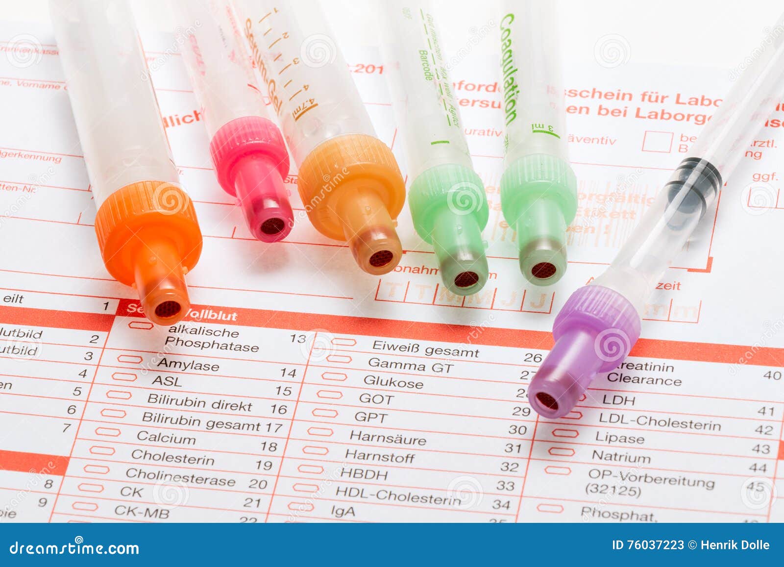 Blood Test, Blood Samples on a Laboratory Form Stock Image Image of