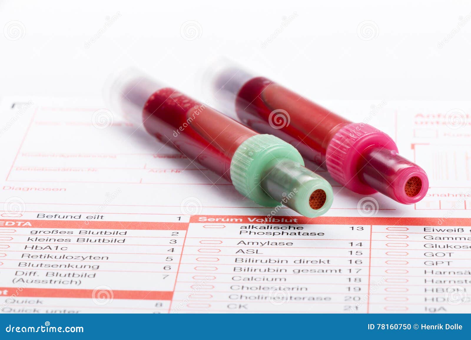 Blood Test, Blood Samples on a Laboratory Form Stock Photo Image of