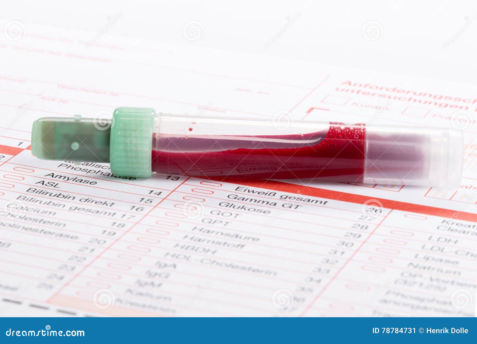 Blood Test, Blood Samples on a Laboratory Form Stock Image Image of