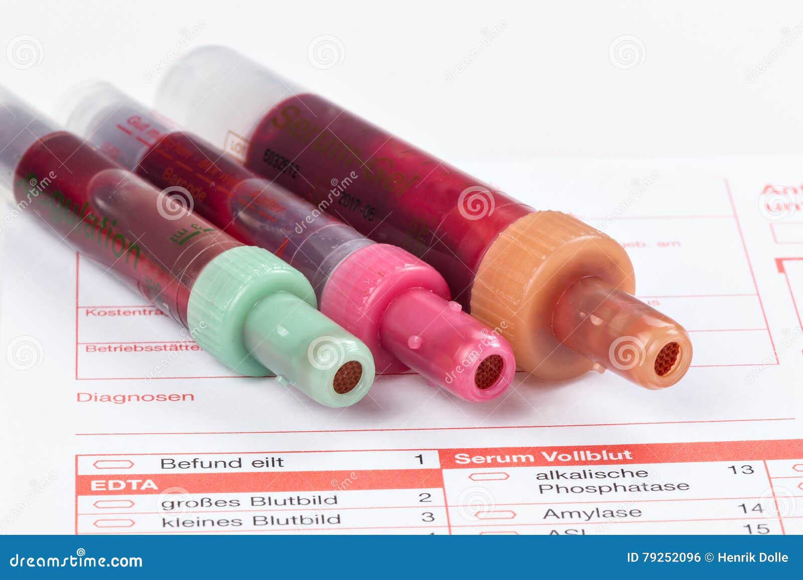 Blood Test, Blood Samples on a Laboratory Form Stock Photo Image of