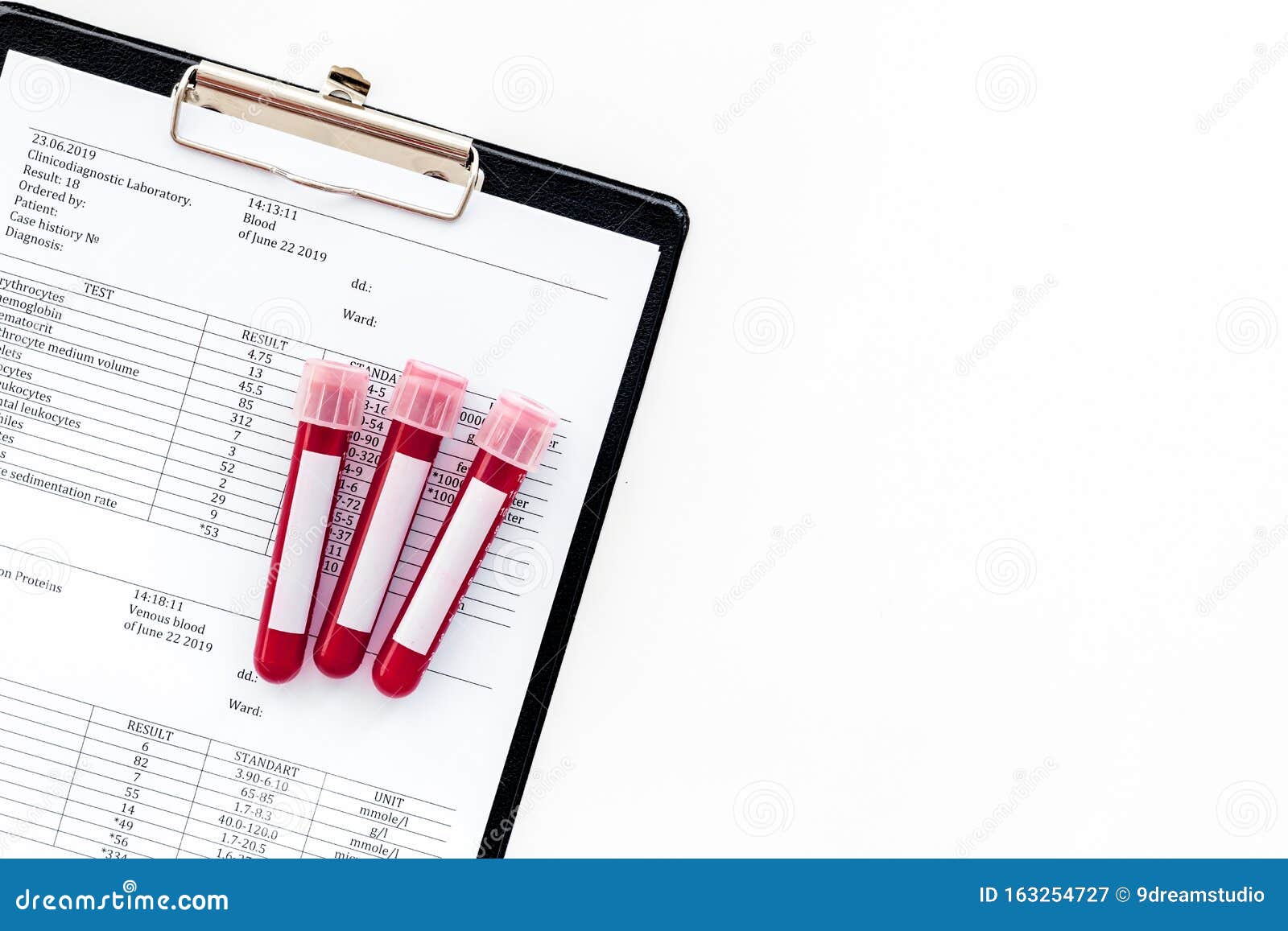 Blood Test Results On White Background Top View Space For Text Stock Image Image Of Chemistry Biotechnology 163254727