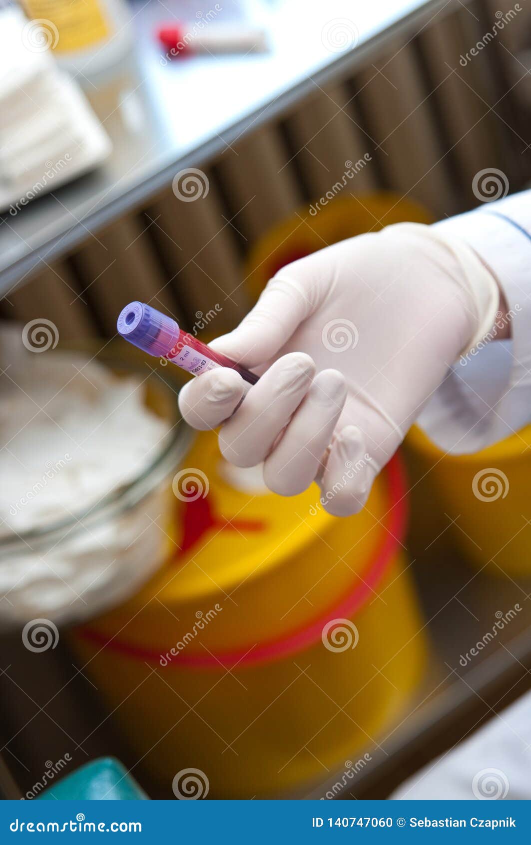 Blood Test Taking Sample Hand Holding Blood Sample Stock Photo Image