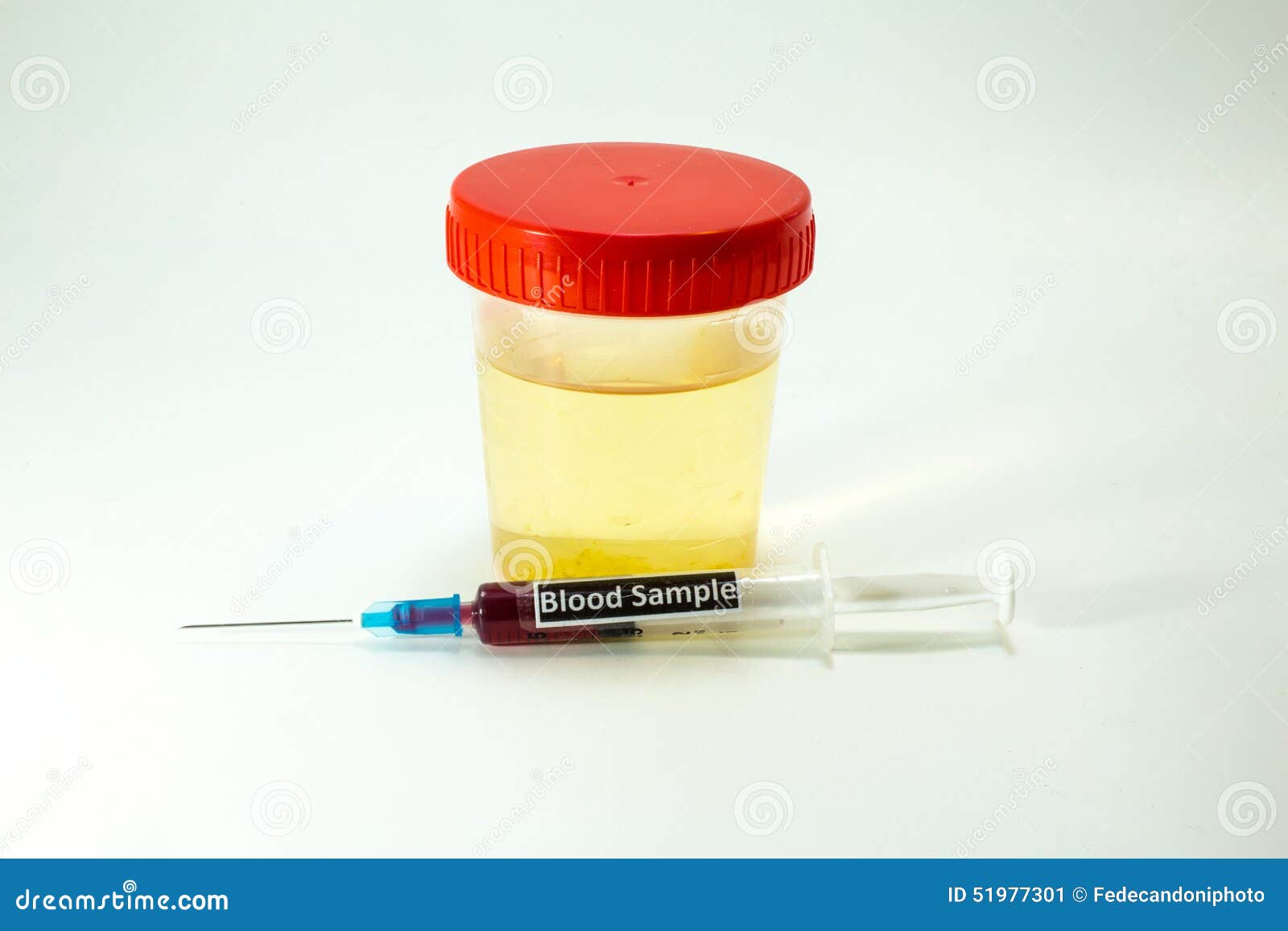 Blood To Be Analyzed and a Specimen of Urine Stock Image Image of
