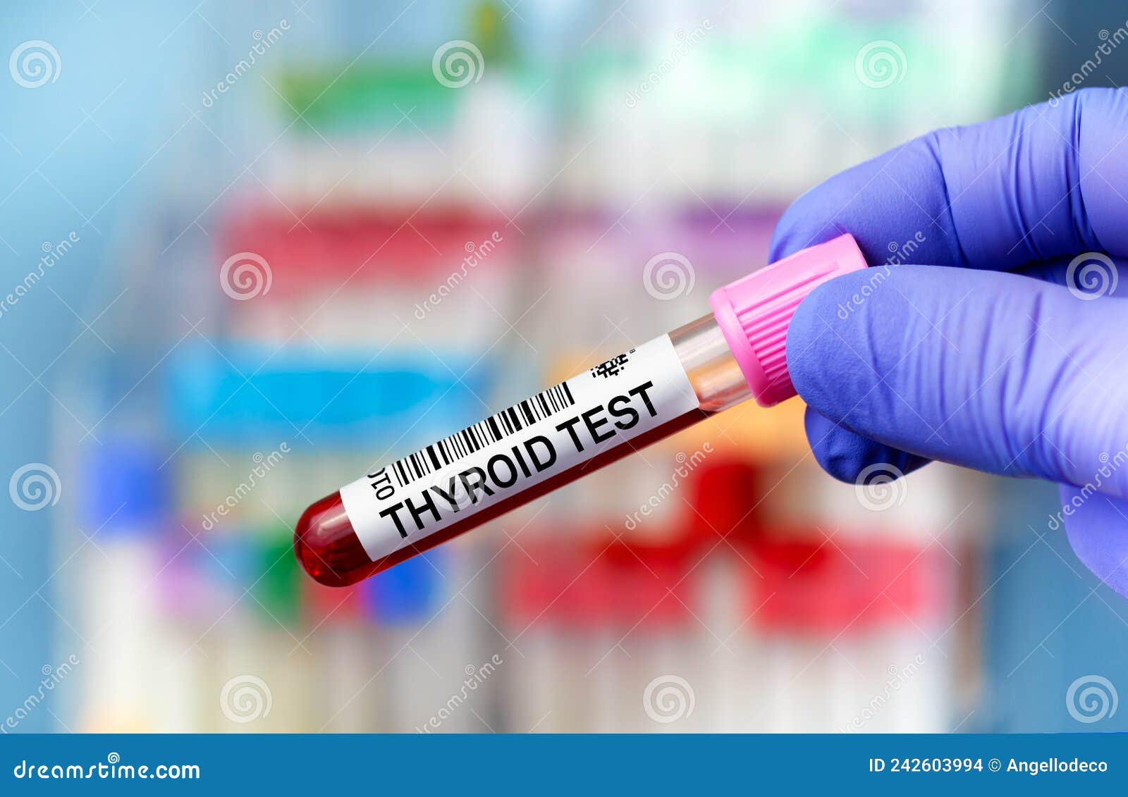 Thyroid Antibodies Stock Photos Free & RoyaltyFree Stock Photos from