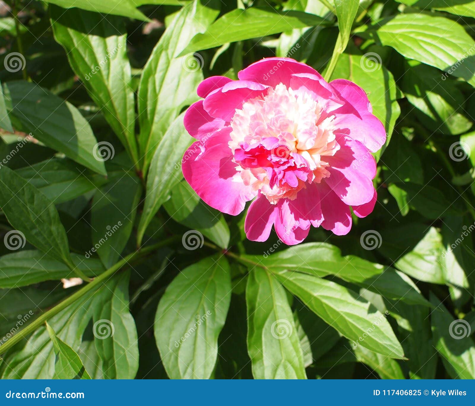 My Image 11