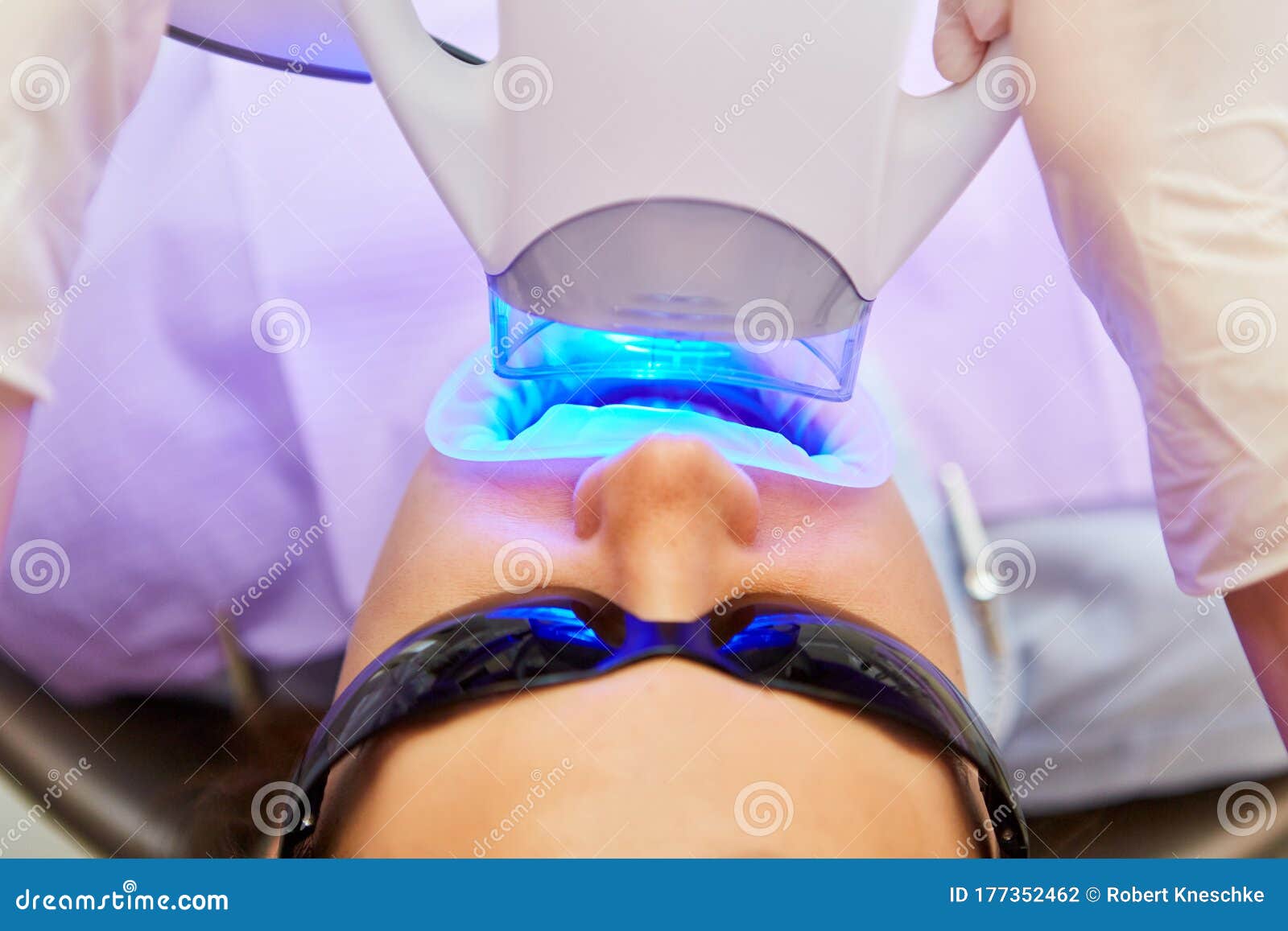 Blue LED Light with Teeth Whitening at the Dentist Stock Photo Image