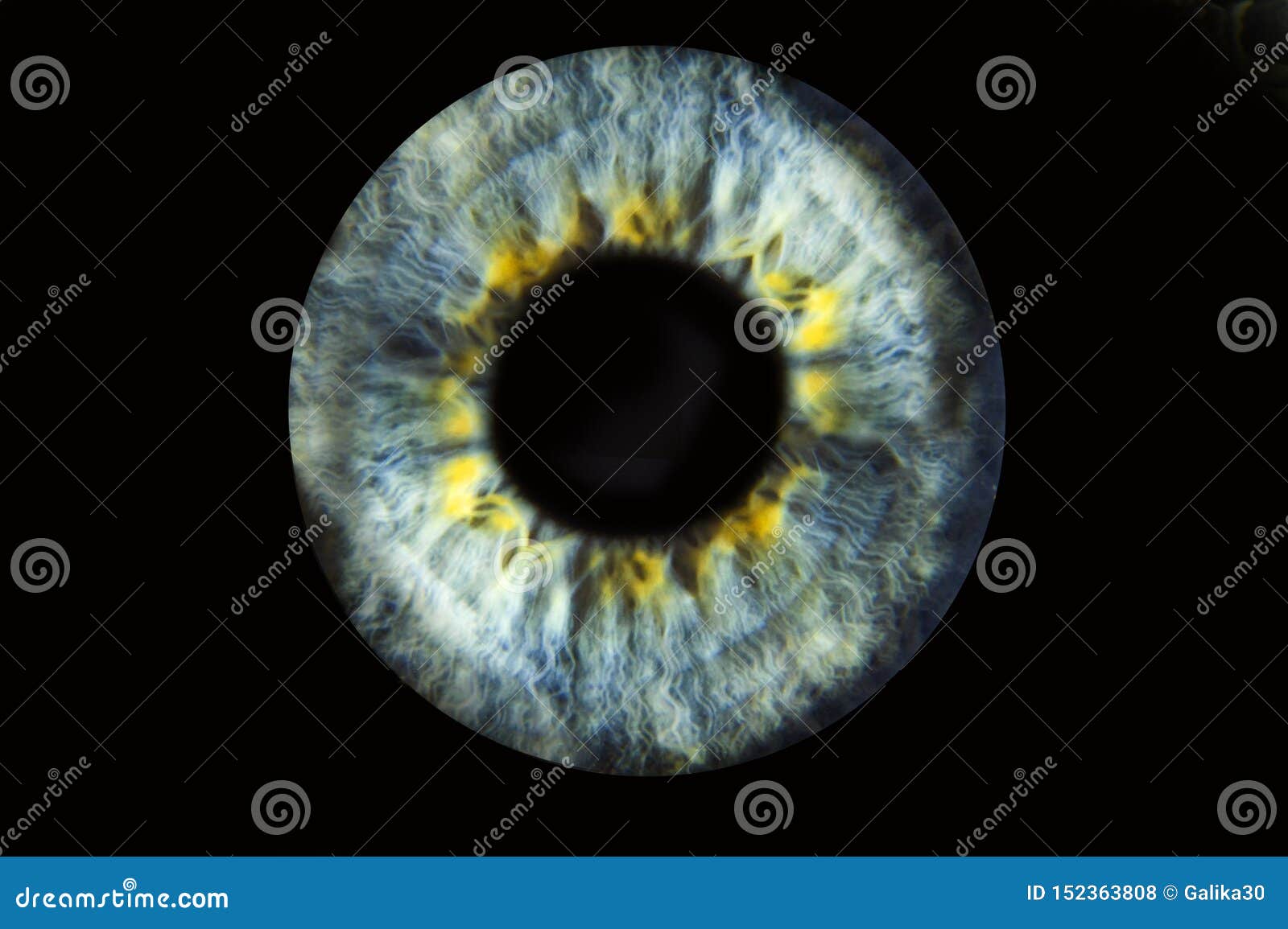 blue eyes yellow around pupil blue eyes yellow around pupil
