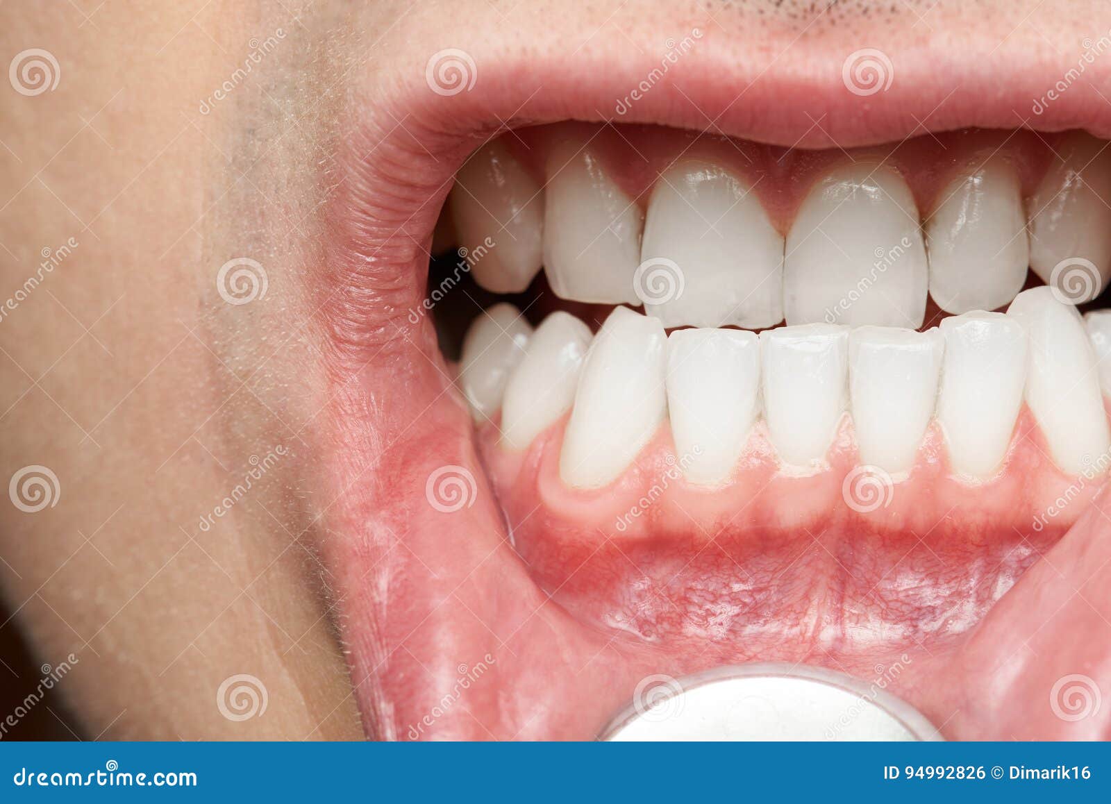 Boca Do Homem Com Dentes Saudáveis Foto de Stock Imagem de higiene
