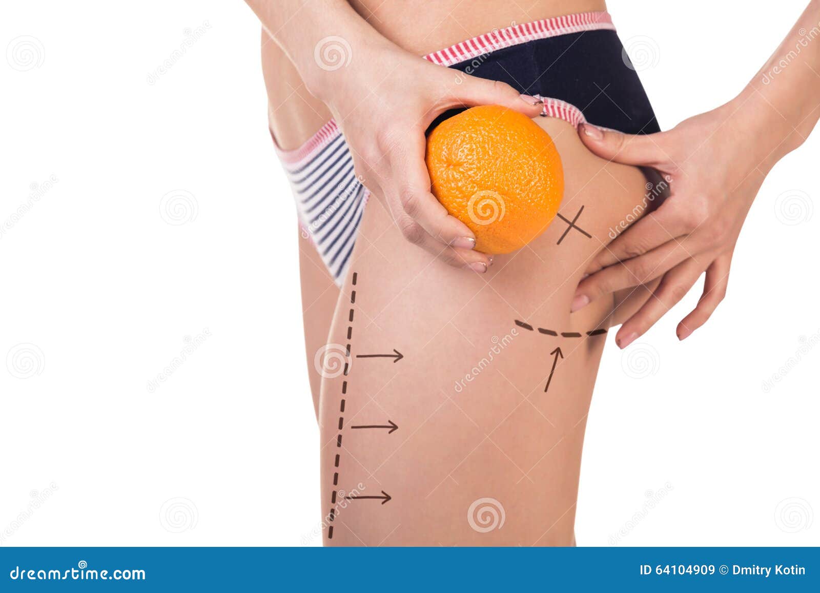 body with cellulitis and orange fruit