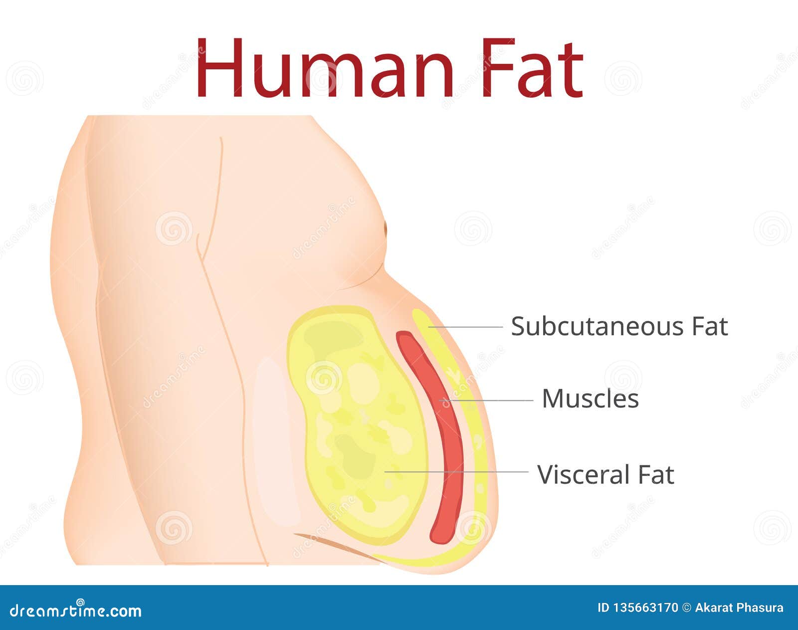 body fat, liposuction, diet , surgery, exercise -  